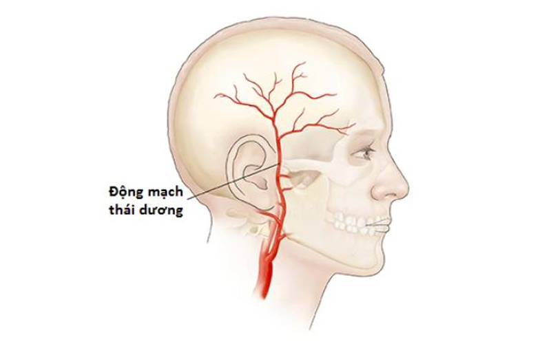 Bệnh viêm động mạch thái dương 