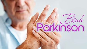 Bệnh Parkinson thường gặp ở người cao tuổi