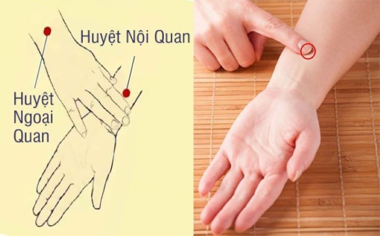 Huyệt nội quan giúp hạ huyết áp hiệu quả