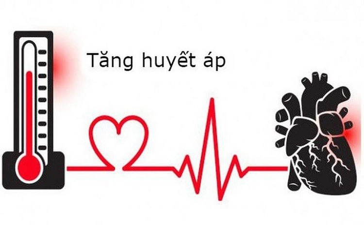 Tăng huyết áp có thể gây nên đột quỵ tim