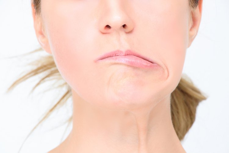 Méo miệng hay một bên mặt là dấu hiệu tai biến mạch máu não phổ biến