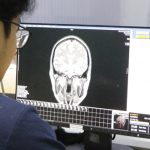Hình ảnh chụp CT não bệnh nhân do bác sĩ cung cấp 