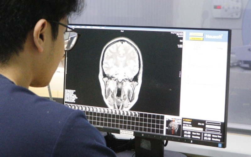 Hình ảnh chụp CT não bệnh nhân do bác sĩ cung cấp 