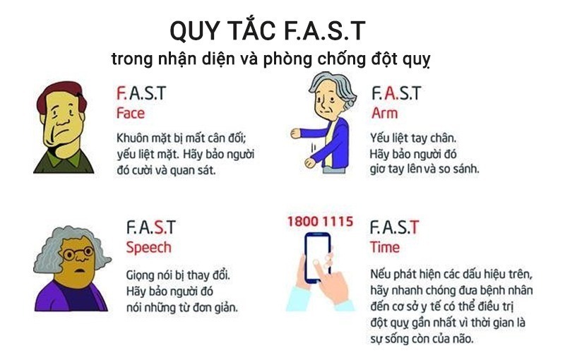 Quy tắc F-A-S-T trong nhận diện dấu hiệu đột quỵ não