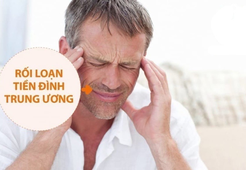 Rối loạn tiền đình trung ương là một bệnh lý hiếm gặp 