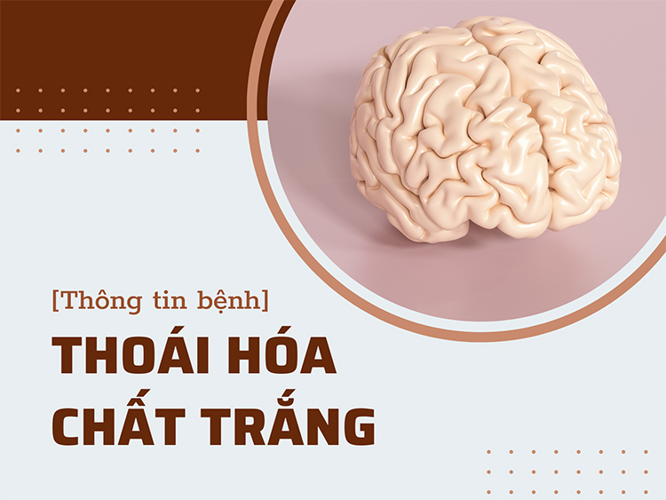 Thoái hóa chất trắng là một bệnh lý nguy hiểm với tỷ lệ tử vong cao