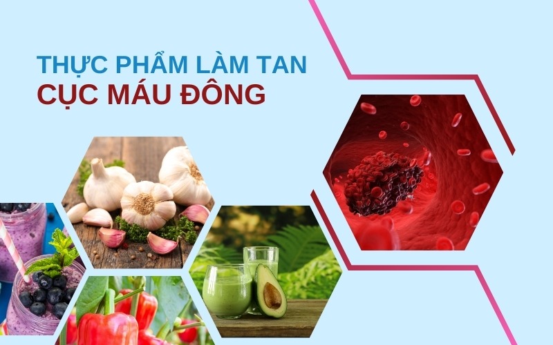 Nhiều thực phẩm có thể hỗ trợ làm tan cục máu đông